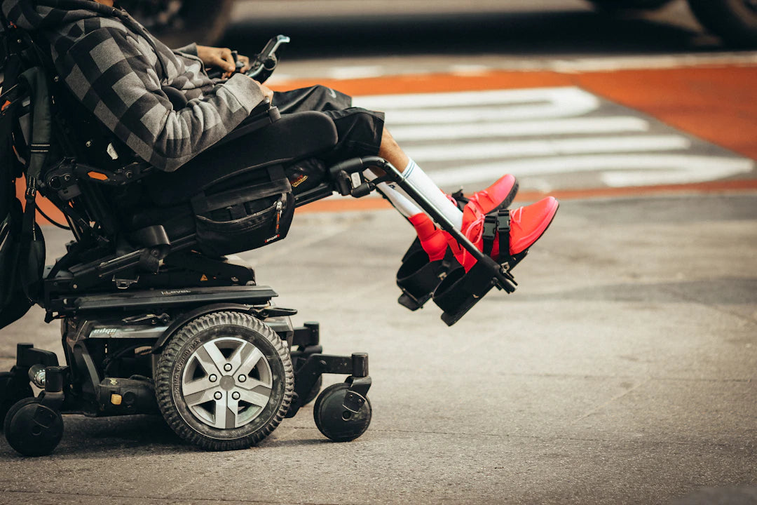 The Future of Mobility Scooters Innovations on the Horizon